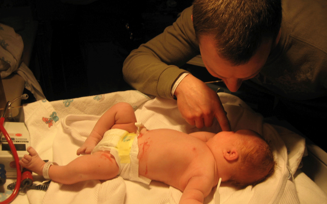 How Down Syndrome Came Into My Life