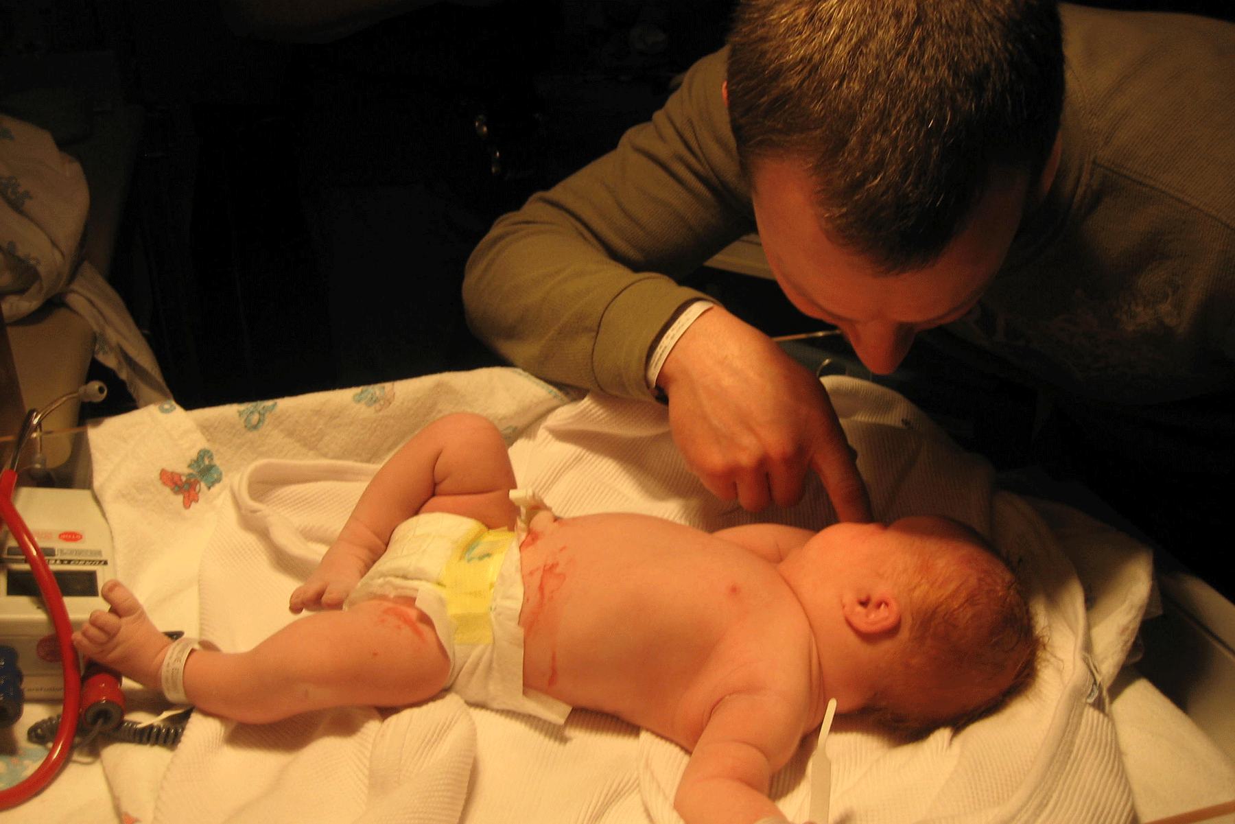The birth of our daughter and her Down Syndrome diagnosis