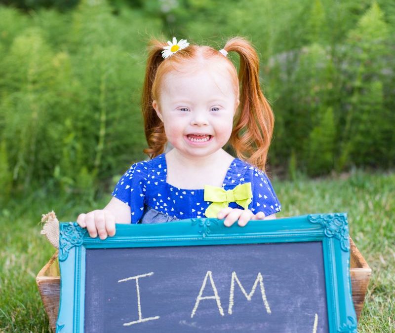 The Beauty of Down Syndrome